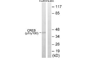 Western blot analysis of extracts from HUVEC cells, treated with etoposide (25uM, 24hours), using CREB (Phospho-Thr100) antibody. (CREB1 Antikörper  (pThr100))
