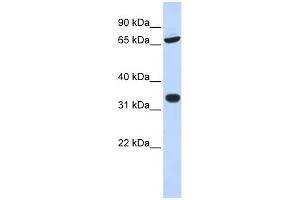 WB Suggested Anti-TRIM28 Antibody Titration:  0. (KAP1 Antikörper  (N-Term))