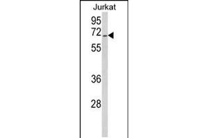 Western blot analysis of RBM14 Antibody in Jurkat cell line lysates (35ug/lane) (RBM14 Antikörper  (AA 193-223))