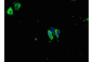 Immunofluorescent analysis of Hela cells using ABIN7165711 at dilution of 1:100 and Alexa Fluor 488-congugated AffiniPure Goat Anti-Rabbit IgG(H+L) (PKC gamma Antikörper  (AA 1-314))