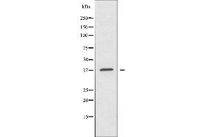 Western blot analysis of extracts from A549 cells using ALDOA antibody. (ALDOA Antikörper  (N-Term))