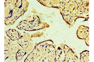 Immunohistochemistry of paraffin-embedded human placenta tissue using ABIN7150705 at dilution of 1:100 (MAP2K3 Antikörper  (AA 1-170))