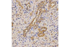 Immunohistochemistry of paraffin-embedded rat kidney using KLK5 antibody (ABIN5971539) at dilution of 1/200 (40x lens). (Kallikrein 5 Antikörper)