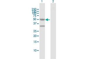 Western Blot analysis of PPM1F expression in transfected 293T cell line by PPM1F MaxPab polyclonal antibody. (PPM1F Antikörper  (AA 1-454))