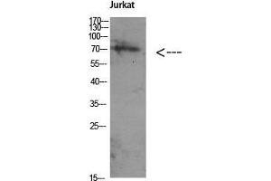 Western Blot (WB) analysis of Jurkat using Antibody diluted at 1:1000. (ATG16L1 Antikörper  (Internal Region))