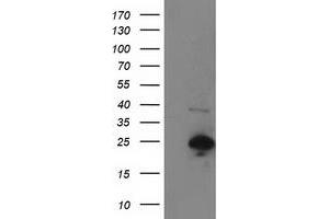 Image no. 1 for anti-Synovial Sarcoma, X Breakpoint 1 (SSX1) antibody (ABIN1501160) (SSX1 Antikörper)