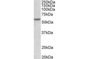 Western Blotting (WB) image for anti-Programmed Cell Death 4 (PDCD4) (Internal Region) antibody (ABIN1108603) (PDCD4 Antikörper  (Internal Region))