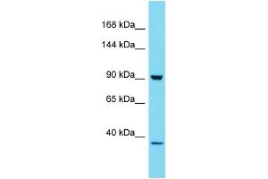 Host: Rabbit Target Name: HKDC1 Sample Type: 293T Whole Cell lysates Antibody Dilution: 1. (HKDC1 Antikörper  (C-Term))