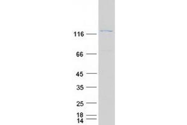 CLTCL1 Protein (Myc-DYKDDDDK Tag)