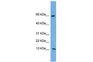 WB Suggested Anti-C20orf144 Antibody Titration: 0. (C20orf144 Antikörper  (Middle Region))
