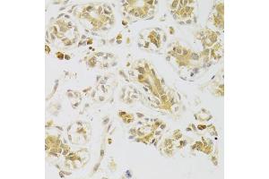 Immunohistochemistry of paraffin-embedded human breast using CASP2 Antibody. (Caspase 2 Antikörper)