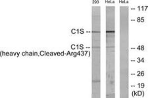Western Blotting (WB) image for anti-Complement Component 1, S Subcomponent (C1S) (AA 388-437), (Cleaved-Arg437) antibody (ABIN2891190) (C1S Antikörper  (Cleaved-Arg437))