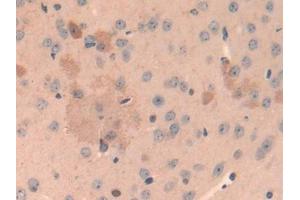 DAB staining on IHC-P; Samples: Mouse Cerebrum Tissue (Cathepsin L Antikörper  (AA 18-113))