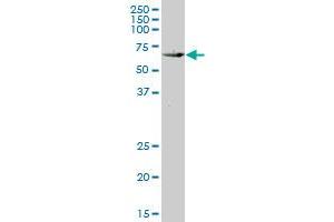 KLF10 monoclonal antibody (M14), clone 2E7. (KLF10/TIEG1 Antikörper  (AA 111-210))