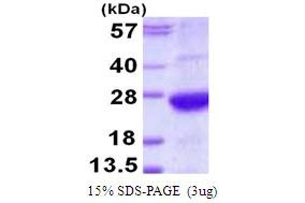 AMBP Protein (AA 20-203) (His tag)