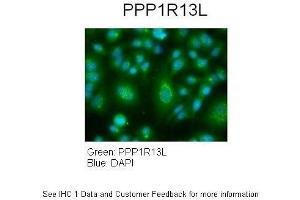 Sample Type :  Human lung adenocarcinoma cell line A549  Primary Antibody Dilution :  1:100  Secondary Antibody :  Goat anti-rabbit AlexaFluor 488  Secondary Antibody Dilution :  1:400  Color/Signal Descriptions :  PPP1R13L: Green DAPI:Blue  Gene Name :  PPP1R13L   Submitted by :  Dr. (PPP1R13L Antikörper  (Middle Region))