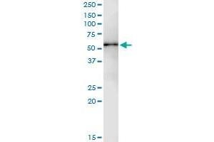 Immunoprecipitation of PPM1F transfected lysate using anti-PPM1F MaxPab rabbit polyclonal antibody and Protein A Magnetic Bead , and immunoblotted with PPM1F purified MaxPab mouse polyclonal antibody (B01P) . (PPM1F Antikörper  (AA 1-454))