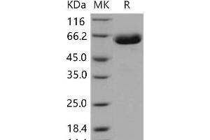 Western Blotting (WB) image for EPH Receptor B1 (EPHB1) (Active) protein (His tag) (ABIN7195545) (EPH Receptor B1 Protein (EPHB1) (His tag))