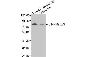 Western blot analysis of extracts from 293 cells, using phospho-PIK3R1/2/3-Y467 antibody (PIK3R1 + PIK3R2 + PIK3R3 (pTyr467) Antikörper)