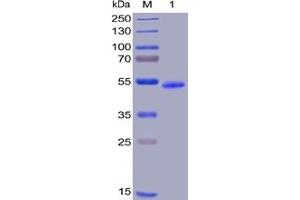 Human GITR Protein, hFc-His Tag on SDS-PAGE under reducing condition. (TNFRSF18 Protein (AA 26-162) (Fc-His Tag))