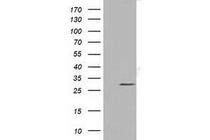 HEK293T cells were transfected with the pCMV6-ENTRY control (Left lane) or pCMV6-ENTRY NSMCE2 (Right lane) cDNA for 48 hrs and lysed. (NSMCE2 Antikörper)