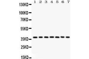 Western Blotting (WB) image for anti-Nucleophosmin (Nucleolar phosphoprotein B23, Numatrin) (NPM1) (AA 1-294) antibody (ABIN3042497) (NPM1 Antikörper  (AA 1-294))