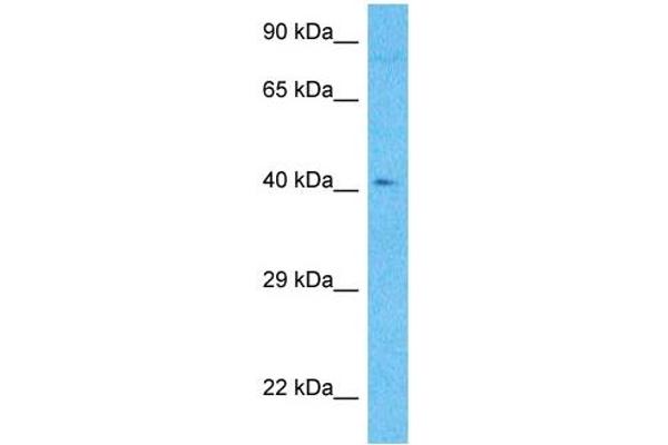 METTL22 Antikörper  (C-Term)