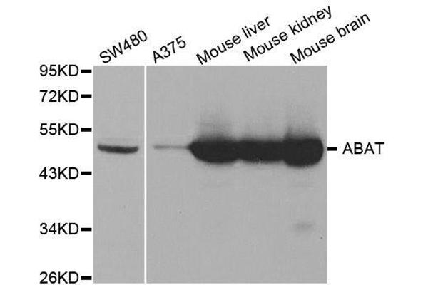 ABAT Antikörper  (AA 29-300)