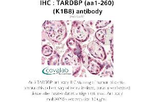 Image no. 1 for anti-TAR DNA Binding Protein (TARDBP) (AA 1-260) antibody (ABIN1723216) (TARDBP Antikörper  (AA 1-260))
