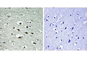 Immunohistochemistry analysis of paraffin-embedded human brain tissue using Chk1 (Phospho-Ser296) antibody. (CHEK1 Antikörper  (pSer296))