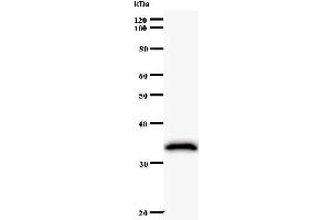 Western Blotting (WB) image for anti-ATP-Dependent RNA Helicase A (DHX9) antibody (ABIN932191) (DHX9 Antikörper)