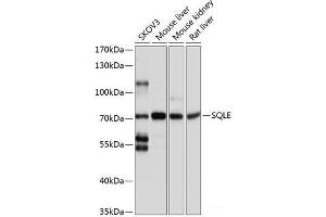 Western blot analysis of extracts of various cell lines using SQLE Polyclonal Antibody at dilution of 1:1000. (SQLE Antikörper)