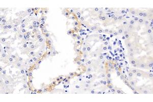 Detection of MMP3 in Human Kidney Tissue using Polyclonal Antibody to Matrix Metalloproteinase 3 (MMP3) (MMP3 Antikörper  (AA 247-370))