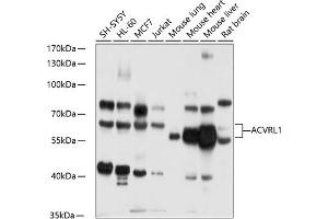 Western blot analysis of extracts of various cell lines, using  antibody (ABIN6129872, ABIN6136507, ABIN6136508 and ABIN6218899) at 1:1000 dilution. (ACVRL1 Antikörper)