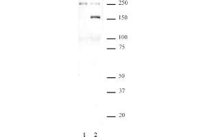 SMC1 phospho Ser957 pAb tested by Western blot. (SMC1A Antikörper  (pSer957))