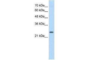 TSHR antibody used at 0. (TSH receptor Antikörper  (C-Term))