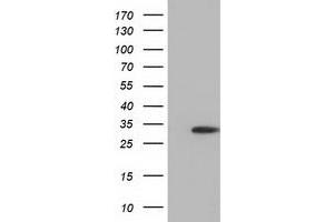 Western Blotting (WB) image for anti-Sulfotransferase Family, Cytosolic, 2A, Dehydroepiandrosterone (DHEA)-Preferring, Member 1 (SULT2A1) antibody (ABIN1501235) (SULT2A1 Antikörper)
