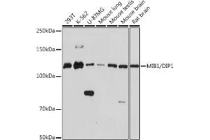 Western blot analysis of extracts of various cell lines, using MIB1/DIP1 Rabbit mAb (ABIN1682649, ABIN3017759, ABIN3017760 and ABIN7101523) at 1:1000 dilution. (MIB1 Antikörper)