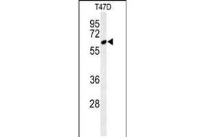 Western blot analysis of CLPB Antibody in T47D cell line lysates (35ug/lane) (CLPB Antikörper  (C-Term))