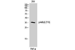 Western Blotting (WB) image for anti-NF-kappa-B inhibitor beta (NFKBIB) (pThr19) antibody (ABIN3173002) (NFKBIB Antikörper  (pThr19))