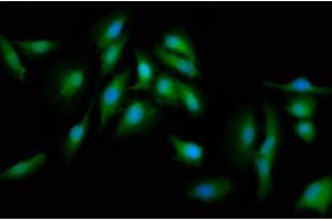 Immunofluorescence staining of Hela cells with ABIN7165702 at 1:133, counter-stained with DAPI. (PKC delta Antikörper  (AA 505-633))