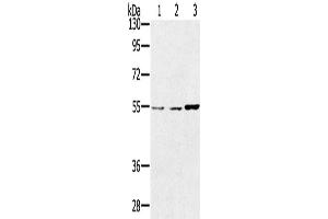 Western Blotting (WB) image for anti-Sestrin 2 (SESN2) antibody (ABIN2433786) (Sestrin 2 Antikörper)