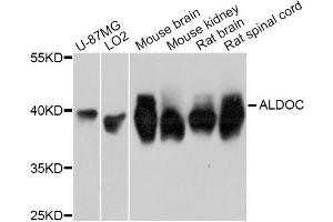 Western blot analysis of extracts of various cell lines, using ALDOC Antibody. (ALDOC Antikörper)