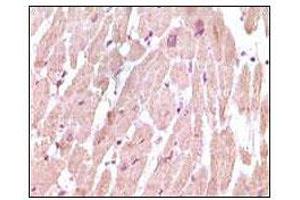 Immunohistochemical analysis of paraffin-embedded human normal cardiac muscle tissue, showing cytoplasmic localization using cTnI mouse mAb with DAB staining. (TNNI3 Antikörper)