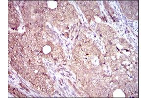 Immunohistochemistry (IHC) image for anti-Integrin beta 4 (ITGB4) (AA 1619-1822) antibody (ABIN1724805)