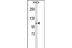 ZN Antibody (N-term) (ABIN657545 and ABIN2846560) western blot analysis in WiDr cell line lysates (35 μg/lane). (ZNF836 Antikörper  (N-Term))