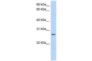 MTHFS antibody used at 1 ug/ml to detect target protein. (MTHFS Antikörper)