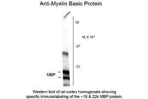 Image no. 1 for anti-Myelin Basic Protein (MBP) antibody (ABIN956786) (MBP Antikörper)