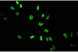 Immunofluorescent analysis of Hela cells treated by NaB using ABIN7139158 at dilution of 1:100 and Alexa Fluor 488-congugated AffiniPure Goat Anti-Rabbit IgG(H+L) (HIST1H3A Antikörper  (acLys14))