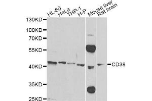 Western blot analysis of extracts of various cell lines, using CD38 Antibody (ABIN1871623) at 1:500 dilution. (CD38 Antikörper)